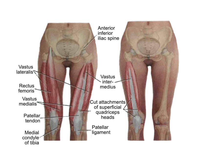 Quadriceps